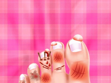 Baby Taylor Foot Treatment